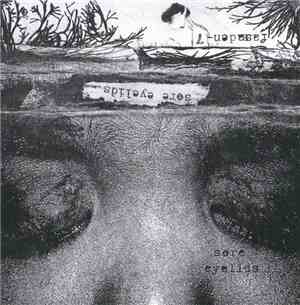Sore Eyelids - Sore Eyelids