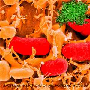 DxTxS - Bacterial Infections Of Necrotizing Wounds