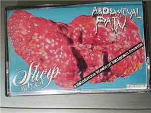 Slurp , Abdominal Pain - A Malodorous Mosaic Of Malignant Growths