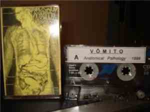 Vômito - Anatomical Pathology