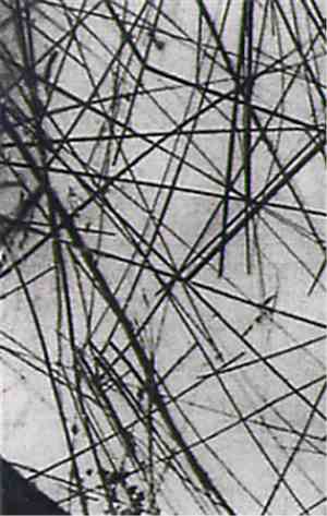 Nathan Surface - Graphite Injections