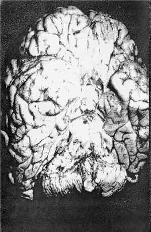 Laughing Venus / Bog Of Dead Flies - Laughing Venus / Bog Of Dead Flies