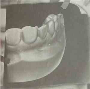 Lorn  - Ghosst(s)