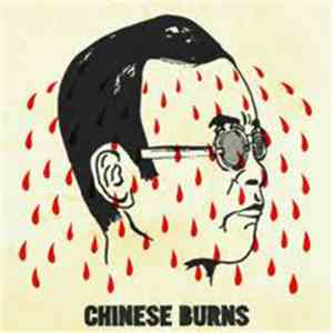 Chinese Burns - Calculator