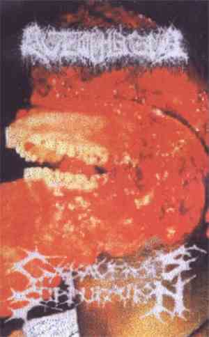 Cadaverous Suppuration / Autophagia - Cadaverous Suppuration / Autophagia