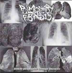 Pulmonary Fibrosis / Agathocles - Broncho-pneumopathie Chronique Obstructiv ...