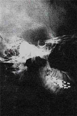 Mardolor - Ciegate Para Siempre