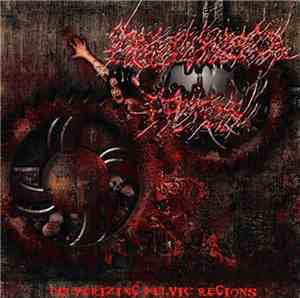 Erythrioblastosis Fetalis - Pulverizing Pelvic Regions