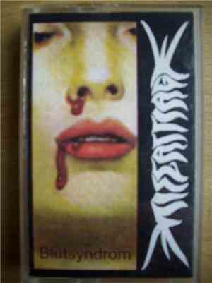 Miscarriage  - Blutsyndrom