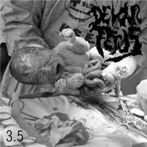 Devour The Fetus - 35