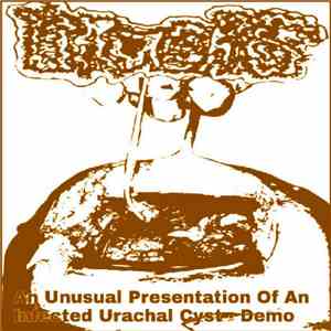 Urachus - An Unusual Presentation Of An Infected Urachal Cyst - Demo