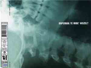 Dopeman  - Te Mibe' Hiszel?