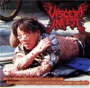 Viscera Infest / Paracoccidioidomicosisproctitissarcomucosis - Gastroduoden ...