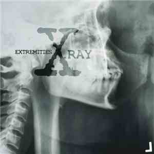 Extremities - X-Ray