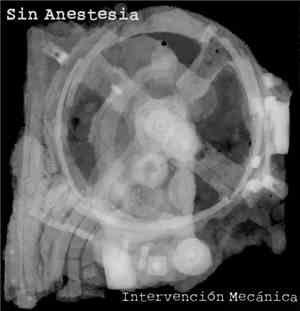 Sin Anestesia - Intervención Mecánica